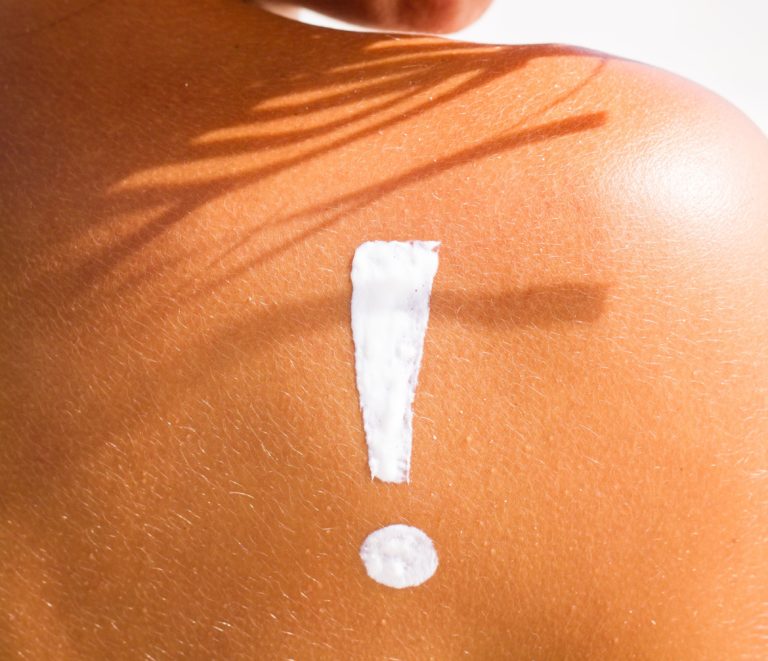 SPF: variabilità dei test interlaboratorio