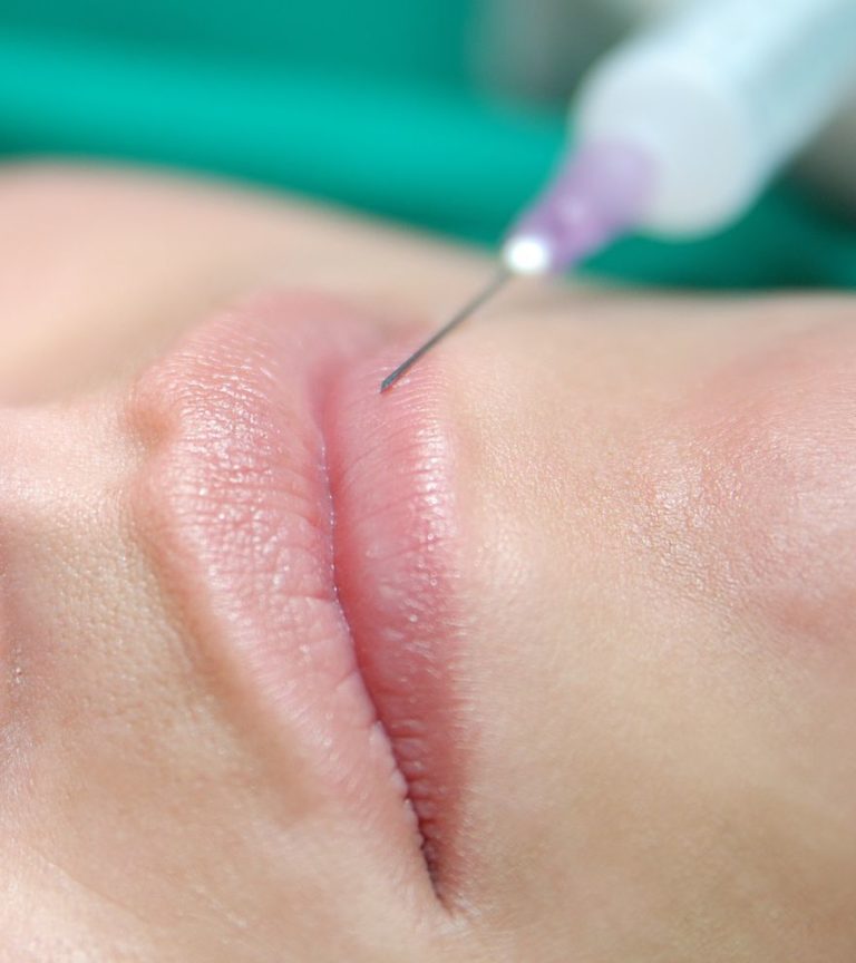 Procedure chirurgiche e cosmetiche minimamente invasive