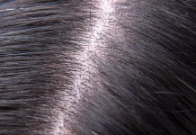 Caffeina e adenosina: effetti su microbioma e lipidoma del cuoio capelluto Caffeina e adenosina: effetti su microbioma e lipidoma del cuoio capelluto