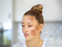 Cosmetici depigmentanti e illuminanti cutanei: il ruolo degli antiossidanti Cosmetici depigmentanti e illuminanti cutanei: il ruolo degli antiossidanti