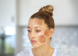 Cosmetici depigmentanti e illuminanti cutanei: il ruolo degli antiossidanti Cosmetici depigmentanti e illuminanti cutanei: il ruolo degli antiossidanti
