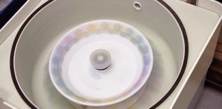 Efficienza dell’analisi proteomica sul frazionamento delle proteine del latte