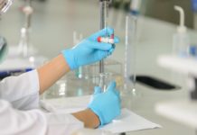 L’acidità di titolazione: significato e applicazioni