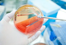 Isolamento di potenziali batteri lattici probiotici