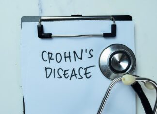 Dieta di esclusione efficace nella malattia di Crohn