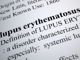 Lupus e integratori a base di erbe: quali possono aumentare l’infiammazione lupus integratori erbe infiammazione