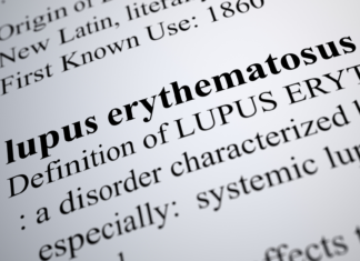 Lupus e integratori a base di erbe: quali possono aumentare l’infiammazione lupus integratori erbe infiammazione