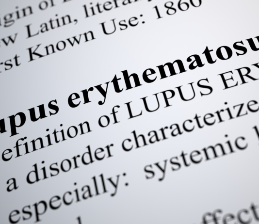 Lupus e integratori a base di erbe: quali possono aumentare l’infiammazione lupus integratori erbe infiammazione