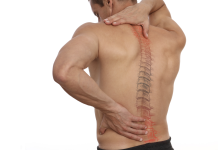 Chiropratica: comportamenti “salvaschiena” in vacanza