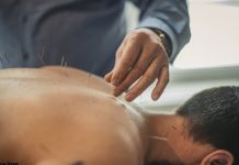 Oncologia Integrata: agopuntura a supporto di radio e chemioterapia nei tumori testa–collo