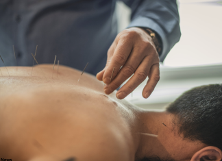 Oncologia Integrata: agopuntura a supporto di radio e chemioterapia nei tumori testa–collo