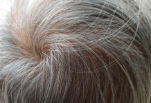 Capelli bianchi, una risposta di difesa anticancro