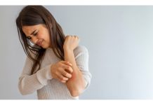 Psoriasi e rimedi naturali, cosa dice la scienza