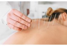 Il ruolo del placebo nell’agopuntura per il dolore cronico