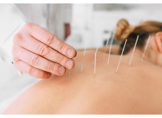 Il ruolo del placebo nell’agopuntura per il dolore cronico