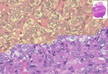 Analisi più rapida ed efficace dei tumori con il supporto dell’IA