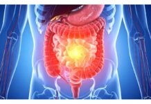 Intestino permeabile