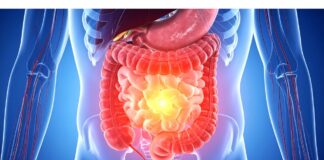 Intestino permeabile