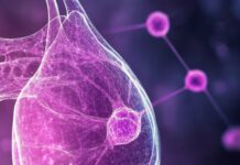 Carcinoma mammario e nutrizione dieta durante la terapia ormonale tumore al seno