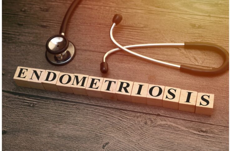 Endometriosi, patologia ancora sottodiagnosticata: marzo mese della consapevolezza Endometriosi e approccio integrato alla gestione del dolore pelvico cronico