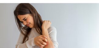 In arrivo l’(H) Open Day sulla psoriasi di Fondazione Onda (H) Open Day sulla psoriasi