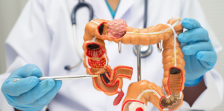 Gestione integrata delle MICI: sfide cliniche e soluzioni emergenti MICI gestione clinica intelligenza artificiale