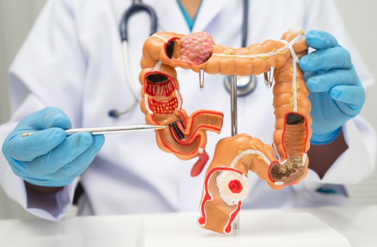 Gestione integrata delle MICI: sfide cliniche e soluzioni emergenti MICI gestione clinica intelligenza artificiale