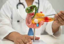 Pancreas Unit in Italia: priorità sanitaria per diagnosi precoce e cure del tumore Pancreas Unit tumore pancreas Italia