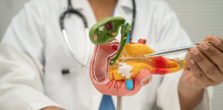 Pancreas Unit in Italia: priorità sanitaria per diagnosi precoce e cure del tumore Pancreas Unit tumore pancreas Italia