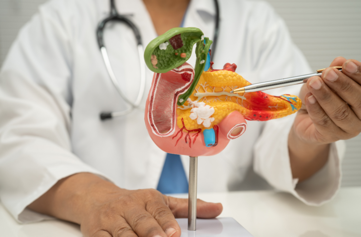 Pancreas Unit in Italia: priorità sanitaria per diagnosi precoce e cure del tumore Pancreas Unit tumore pancreas Italia