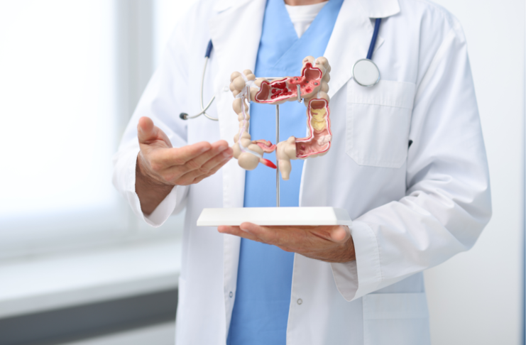 Malattie infiammatorie croniche intestinali: l’importanza della nutrizione e delle strategie individualizzate Malattie infiammatorie croniche intestinali