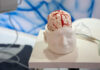 IA in neurochirurgia: le nuove applicazioni presentate al Congresso SINch Congresso SINch 2026