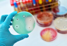 Antibiotico-resistenza in Italia: dati AR-ISS, diagnosi e terapie sul territorio antibiotico-resistenza in Italia