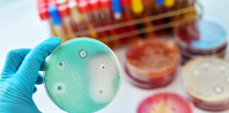 Antibiotico-resistenza in Italia: dati AR-ISS, diagnosi e terapie sul territorio antibiotico-resistenza in Italia