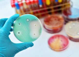 Antibiotico-resistenza in Italia: dati AR-ISS, diagnosi e terapie sul territorio antibiotico-resistenza in Italia