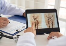 Giornata Mondiale dell’Ictus: prevenzione, Stroke Unit e tecnologie Giornata Mondiale dell’Ictus