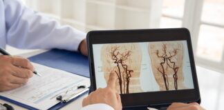 Giornata Mondiale dell’Ictus: prevenzione, Stroke Unit e tecnologie Giornata Mondiale dell’Ictus