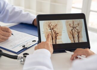Giornata Mondiale dell’Ictus: prevenzione, Stroke Unit e tecnologie Giornata Mondiale dell’Ictus