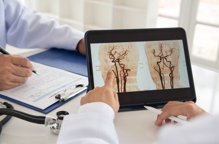 Giornata Mondiale dell’Ictus: prevenzione, Stroke Unit e tecnologie Giornata Mondiale dell’Ictus