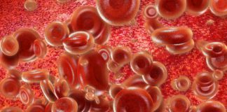 Ema: patient records and real world data for clinical studies on hemophilia