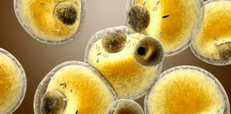 Evolocumab: lowering LDL-C to unprecedented levels did not negatively impact cognition