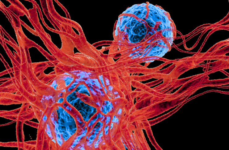 Cancer medicines: faster approvals, but access remains uneven across Europe