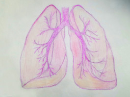 BI 1482694 per carcinoma polmonare non a piccole cellule avanzato