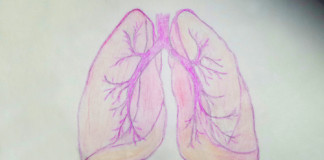 BI 1482694 per carcinoma polmonare non a piccole cellule avanzato