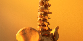 Spondilite anchilosante