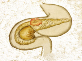 Nab-paclitaxel/gemcitabina per il carcinoma del pancreas