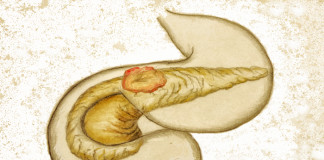 Nab-paclitaxel/gemcitabina per il carcinoma del pancreas