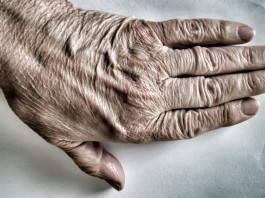 Certolizumab pegol per l’artrite reumatoide
