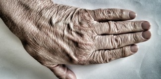 Certolizumab pegol per l’artrite reumatoide