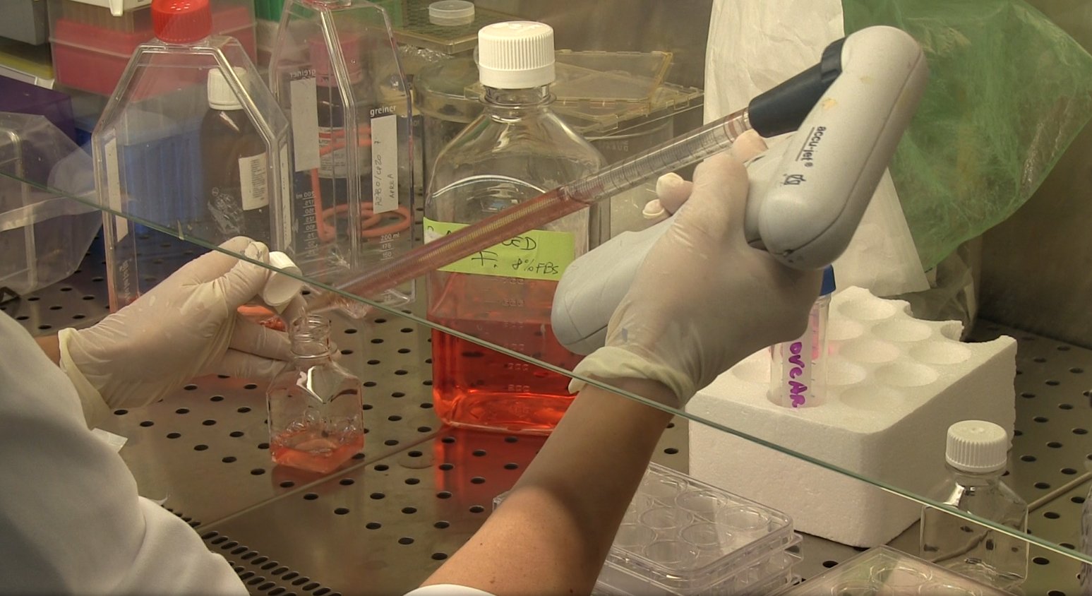 "Il trasferimento tecnologico è l'anello mancante tra Accademia e Impresa per trasferire tempestivamente l’innovazione tecnologica nella pratica clinica grazie a strutture specializzate"